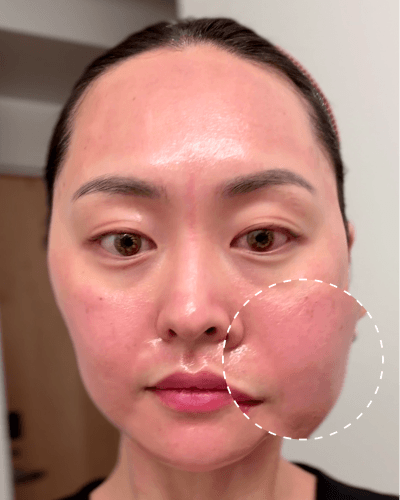 before image