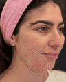 thumbnail before image