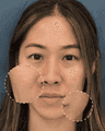 thumbnail after image