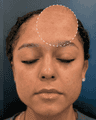 thumbnail before image