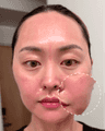 thumbnail before image