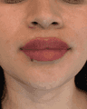 thumbnail after image