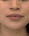 thumbnail before image
