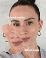 thumbnail after image