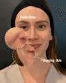 thumbnail before image