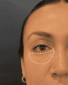 thumbnail after image