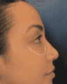 thumbnail after image