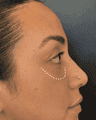 thumbnail before image