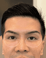 thumbnail after image
