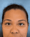 thumbnail after image