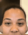 thumbnail before image