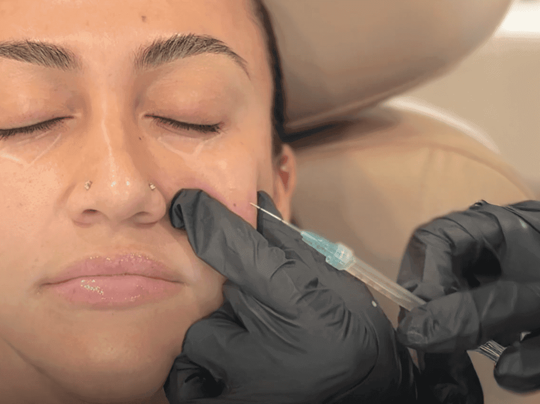 Rejuvenation Injection