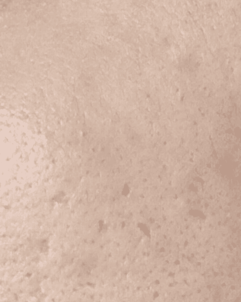 after image