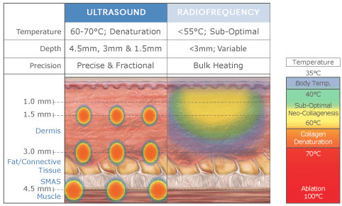 Good Heat vs Bad Heat for Your Skin: If You Don’t Know, Your Skin Could Be Damaged at MeSO MedSpa