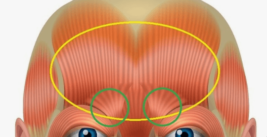 For Those Getting MeSO Tox on Their Forehead or Between the Eyebrows, Please Read This Carefully at…