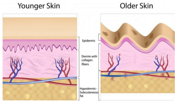 Collagen vs.