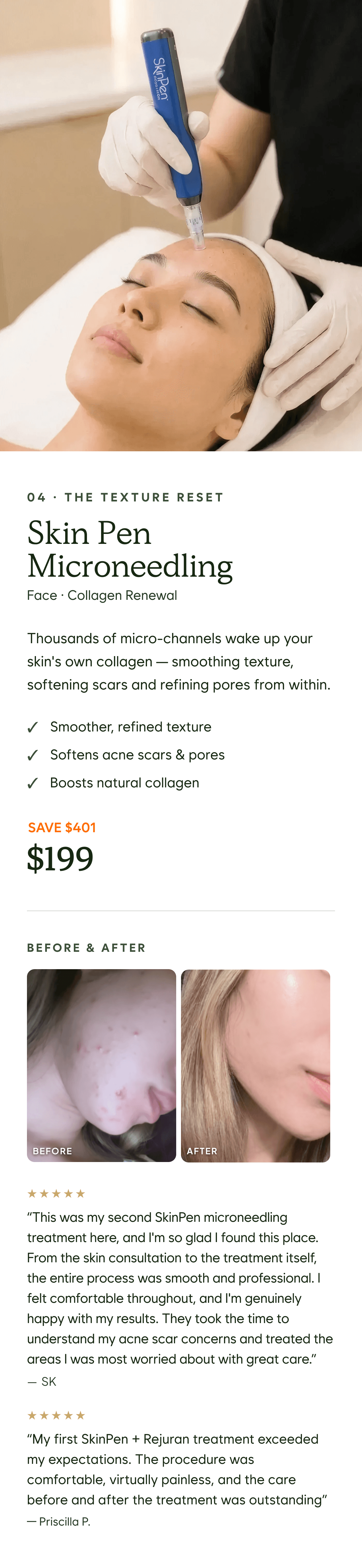Skin Pen Microneedling